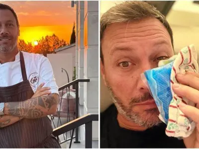 Лео Бианки уплаши феновете: Появи се с посинено око! Жена му ли го бушонира