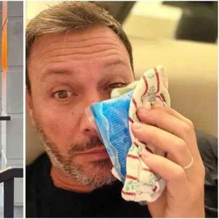 Лео Бианки уплаши феновете: Появи се с посинено око! Жена му ли го бушонира