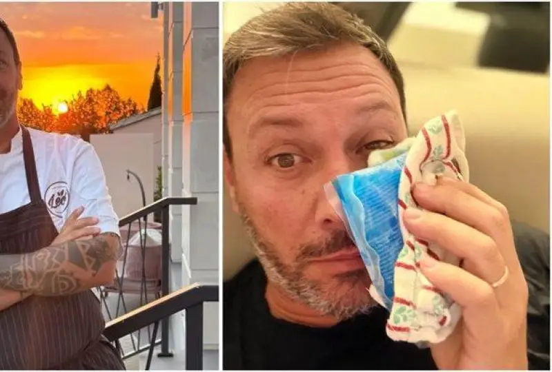 Лео Бианки уплаши феновете: Появи се с посинено око! Жена му ли го бушонира