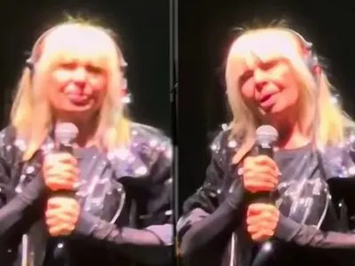 Лили изду устни, феновете в шок: Красотата идва от класата, не от филъри