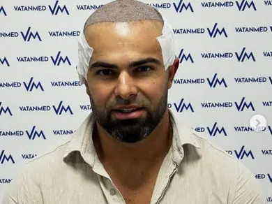 Ричард Величков  си присади коса  на промоция заради „Ергенът”