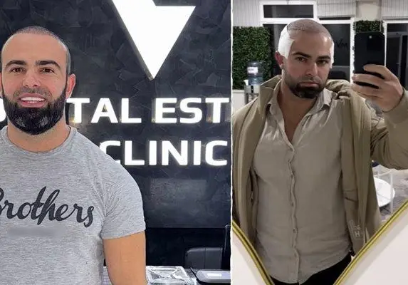 Ричи Тъпото шокира с нова визия и смели признания!