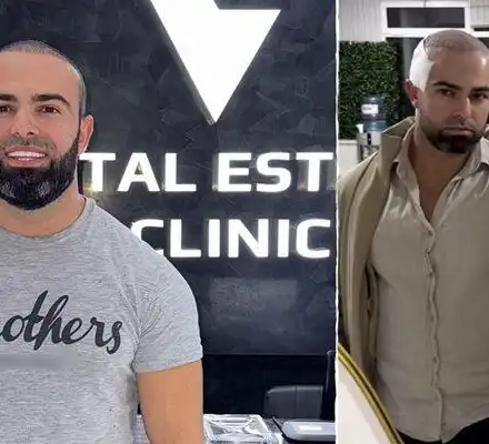 Ричи Тъпото шокира с нова визия и смели признания!