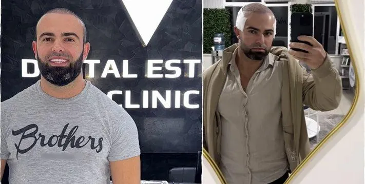 Ричи Тъпото шокира с нова визия и смели признания!