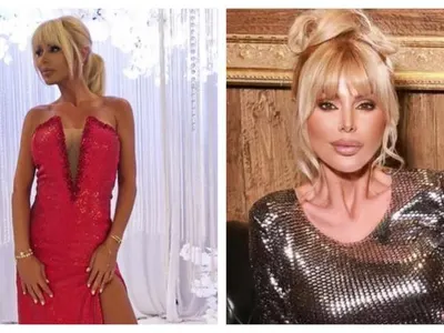 Светлана Гущерова е в последни стадии на анорексия