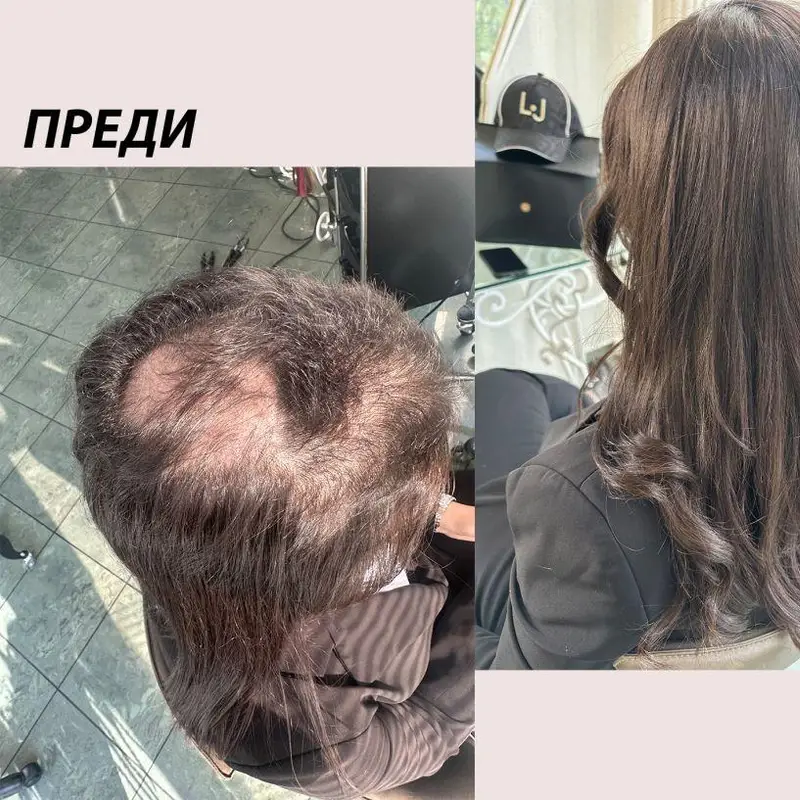 Трансформацията, която шокира България: Химиотерапия и нова визия!