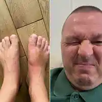 Шок! Гъмзата с тежка травма у дома – какво се случи?