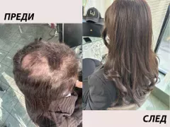 Трансформацията, която шокира България: Химиотерапия и нова визия!
