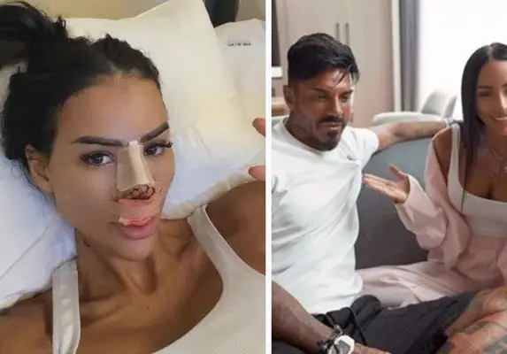 За втори път: Новата на Благо Джизъса си сряза носа