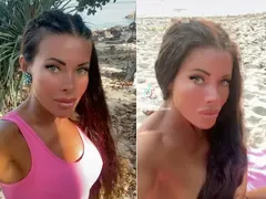 Меги Дерм шокира с операция: Изрязаха половината й черен дроб!