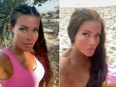 Меги Дерм шокира с операция: Изрязаха половината й черен дроб!