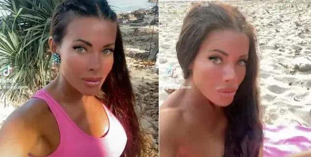 Меги Дерм шокира с операция: Изрязаха половината й черен дроб!