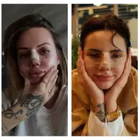 Масова истерия сред ергенките: Режат си носовете, но по-красиви ли са? (СНИМКИ)