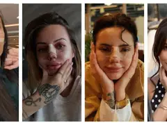 Масова истерия сред ергенките: Режат си носовете, но по-красиви ли са? (СНИМКИ)