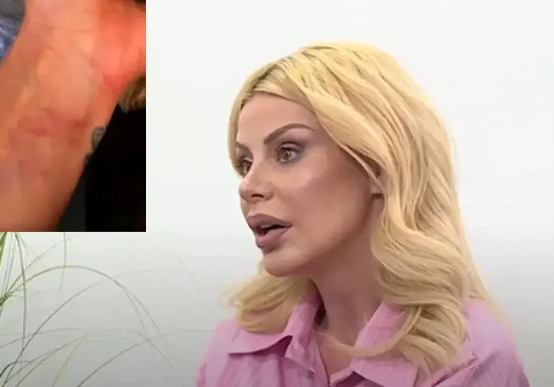 Не подбира ли кого „обслужва“?! Светлана Василева показа синините по тялото си, след побоя от новия „любим“! (ШОК СНИМКИ)