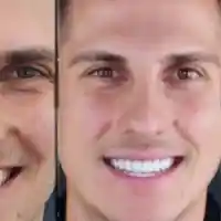 Петър от „Ергенът“ шокира с нова визия: фасети и ботокс!