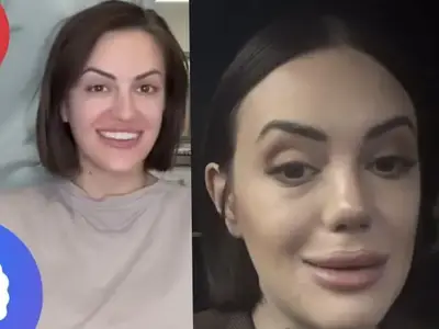 След новия си нос!! Анна-Мария Граченова каза: Харесвам се! (че какво друго да каже, като връщане няма - СНИМКИ)