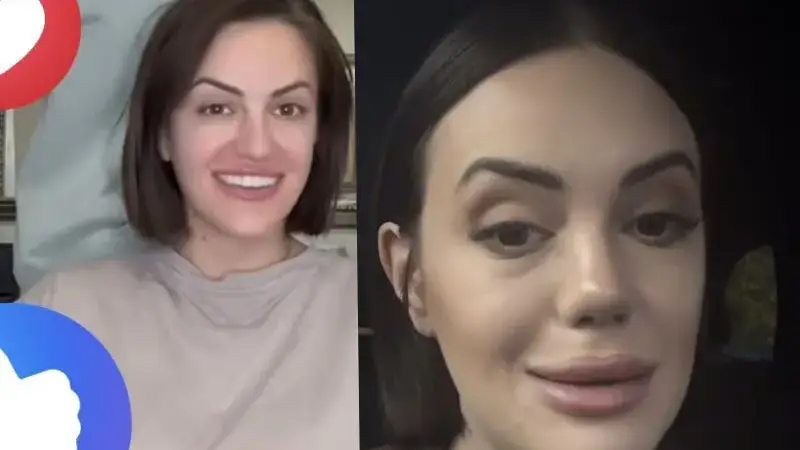 След новия си нос!! Анна-Мария Граченова каза: Харесвам се! (че какво друго да каже, като връщане няма - СНИМКИ)