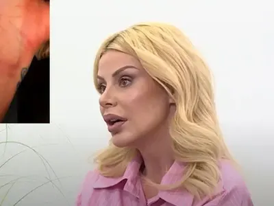 Светлана Василева показа СИНИНИТЕ от побоя снощи! (СНИМКИ)