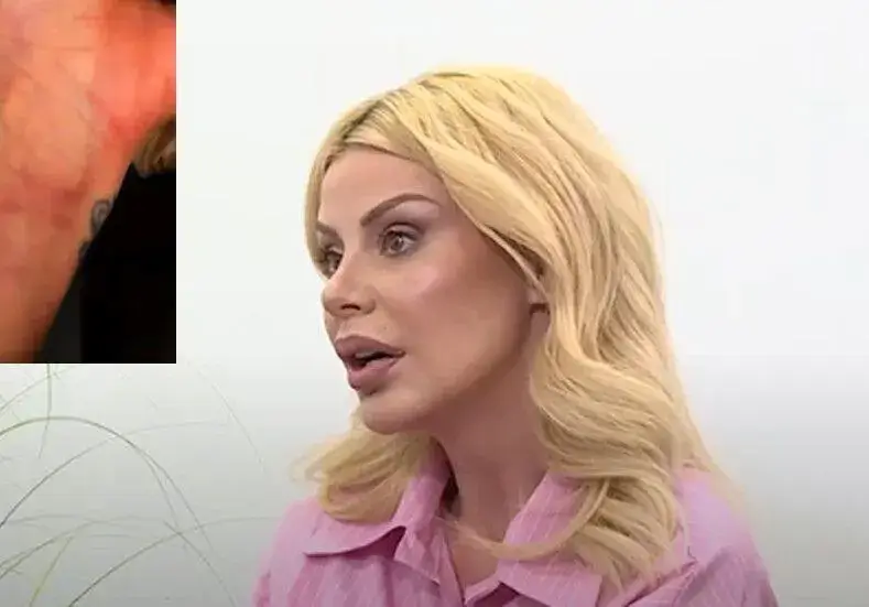 Светлана Василева показа СИНИНИТЕ от побоя снощи! (СНИМКИ)