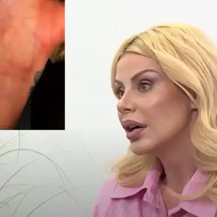 Светлана Василева показа СИНИНИТЕ от побоя снощи! (СНИМКИ)