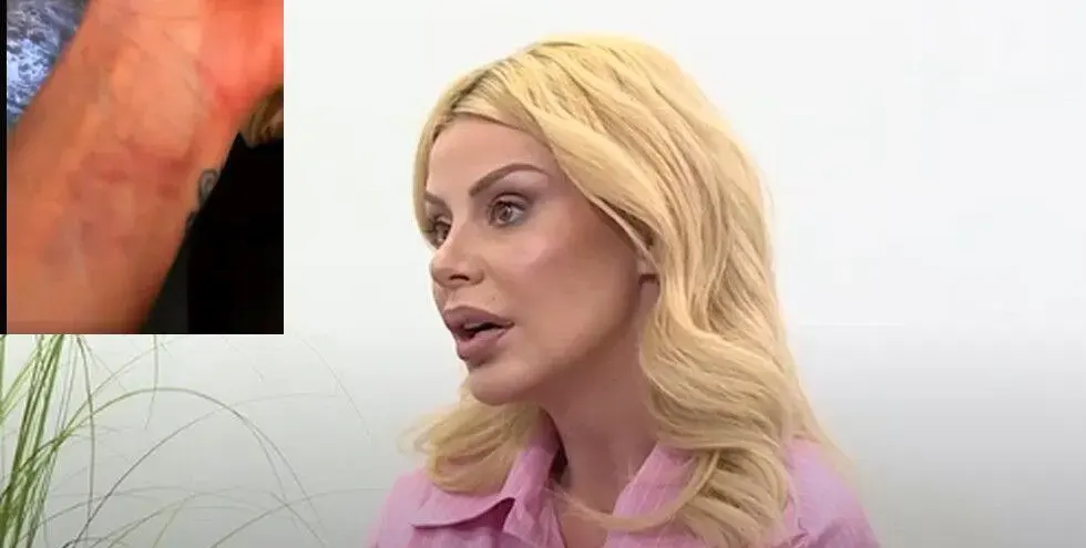 Светлана Василева показа СИНИНИТЕ от побоя снощи! (СНИМКИ)