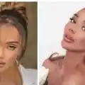 Биляниш шокира с мисли за ринопластика! Какво се случва?