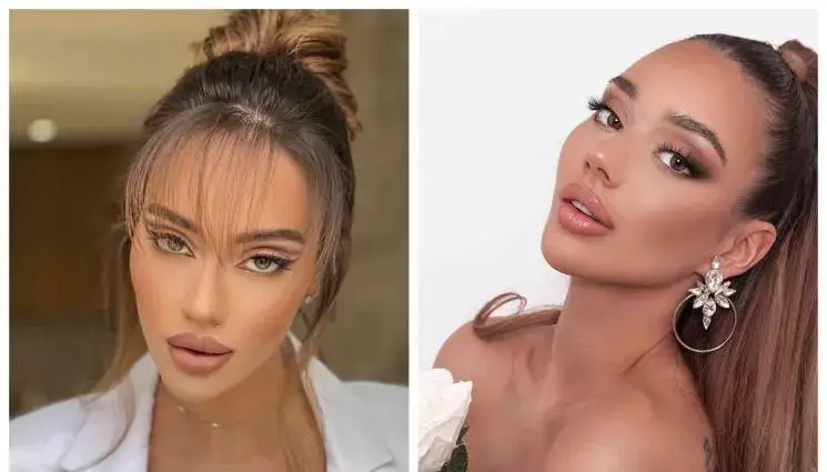 Биляниш шокира с мисли за ринопластика! Какво се случва?