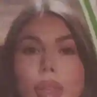 Носът на Даниела Руецова се разпада