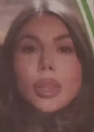 Носът на Даниела Руецова се разпада