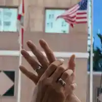 Най-пазената ТАЙНА: Азис каза „Да“ на тайнствен хирург (СНИМКИ)