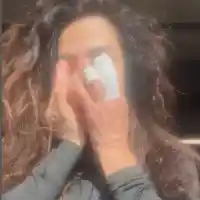 Шок! Маги Сидерова загуби пръст след нападение от питбула си!