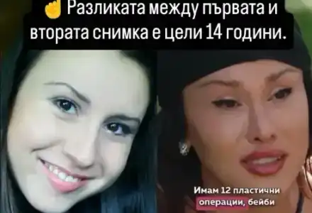 Шок! Санта Китана разкрива шокиращи снимки "преди" операции!