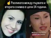 Шок! Санта Китана разкрива шокиращи снимки "преди" операции!