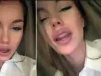 Скандал! Звездните дъщери шокират с пластични операции!