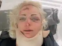 Жанета Осипова пострада (ФОТО)