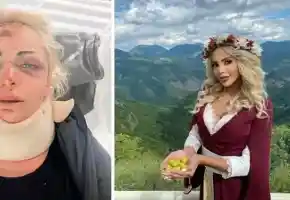 Шокираща история на Жанета Осипова: Оцелях след зверства и катастрофа!