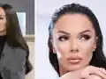 Галена шокира с увиснала кожа! Какво е Оземпик?