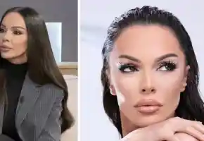 Галена шокира с увиснала кожа! Какво е Оземпик?