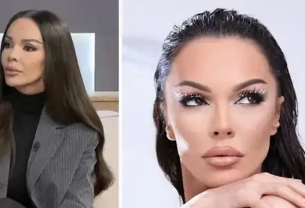 Галена шокира с увиснала кожа! Какво е Оземпик?