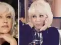 Джуджи се опъна с лифтинг конци