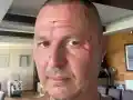 Шок! Гъмзата с ужасна злополука след разкрасителна процедура