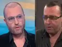 Шок! Нойзи се защити: Не съм си присадил коса!