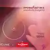 Шокираща кампания: Техномаркет и Acibadem City Clinic срещу рака!